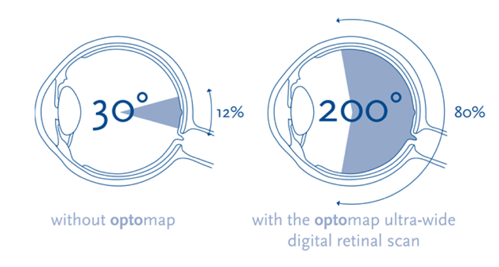 Optomap Infographic